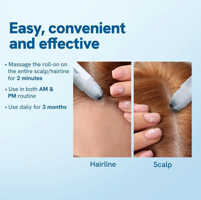 Rosemary Hair Growth Roll-on Serum | Natural Essence for Hair Loss & Growth