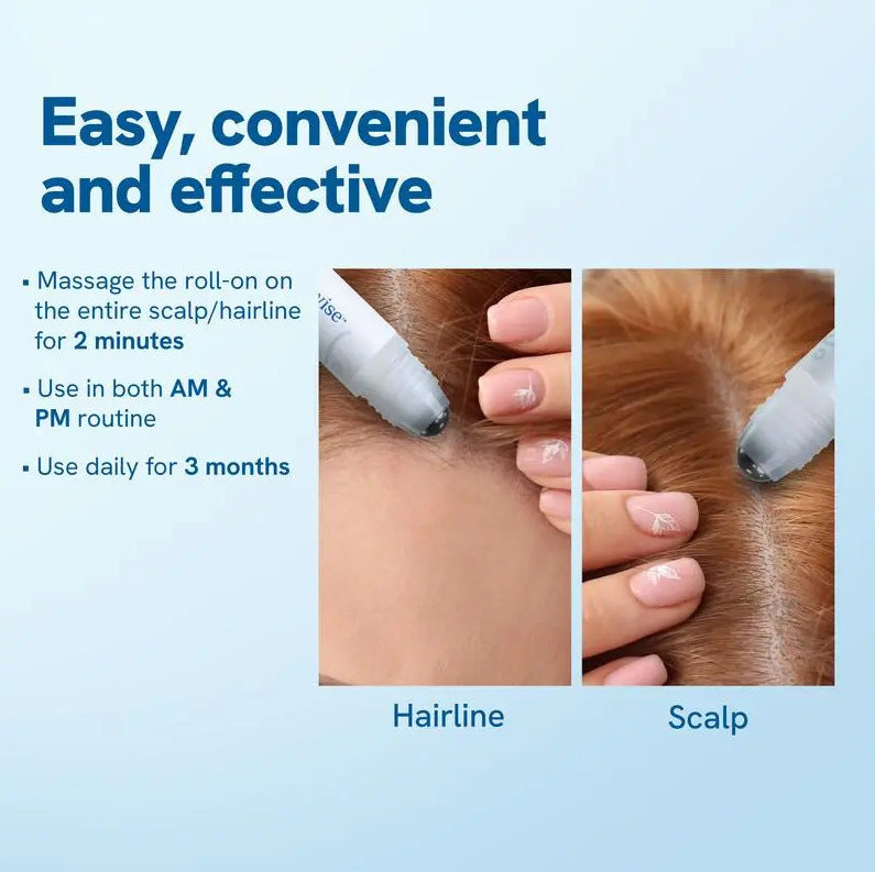 Rosemary Hair Growth Roll-on Serum | Natural Essence for Hair Loss & Growth