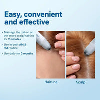 Rosemary Hair Growth Roll-on Serum | Natural Essence for Hair Loss & Growth